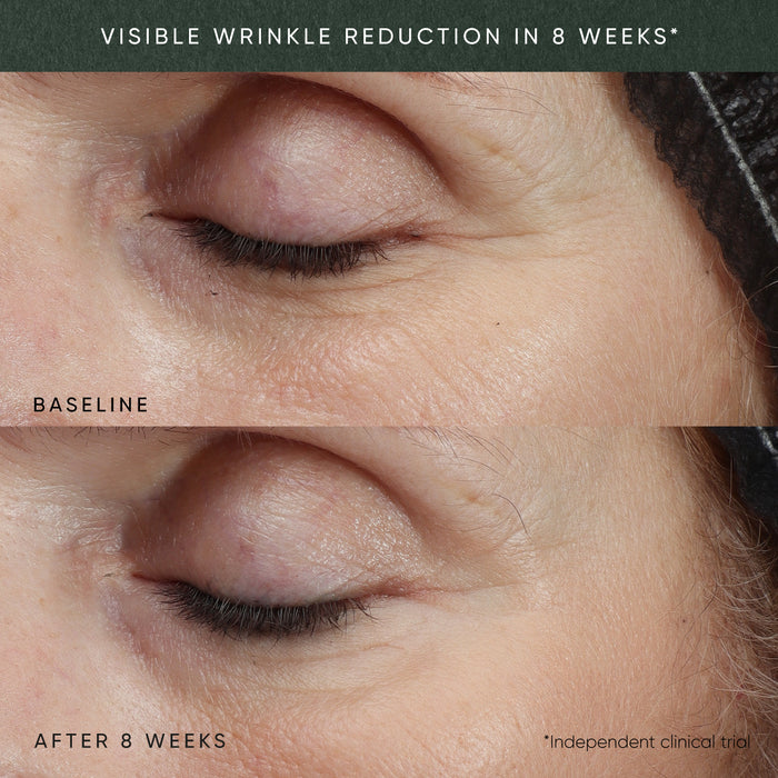 Before and after comparison of eye wrinkles with text indicating wrinkle reduction in 8 weeks.
